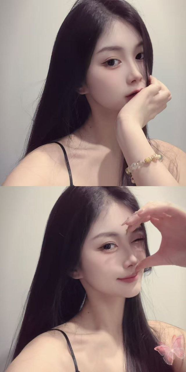 155726